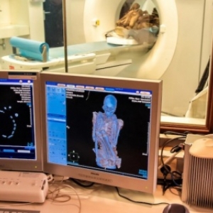 La momie de "Rascar Capac" passee a la radioscopie 3D dans un scanner ultra performant (c) "Panoramique Terre Productions"